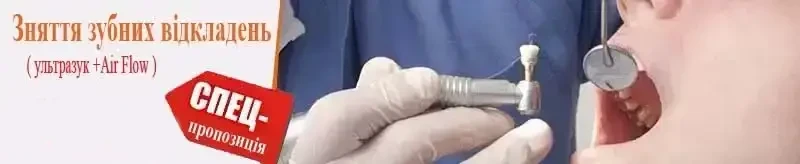 Акція на чистку зубів