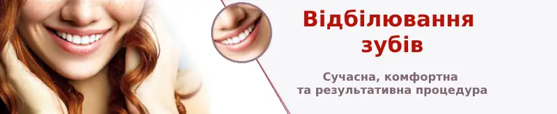 Акція. Відбілювання зубів зі знижкою.